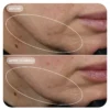 VOL.U.LIFT GLP-1 4D Skin Rebound Complex