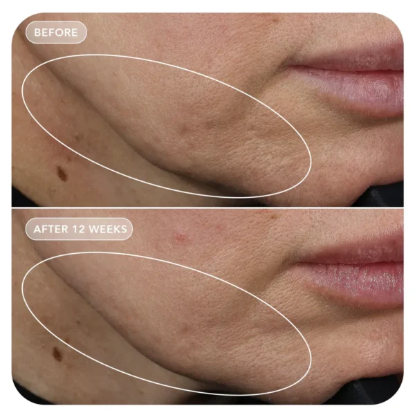 VOL.U.LIFT GLP-1 4D Skin Rebound Complex